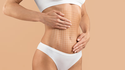 An Expert Guide to Tummy Tuck Surgery