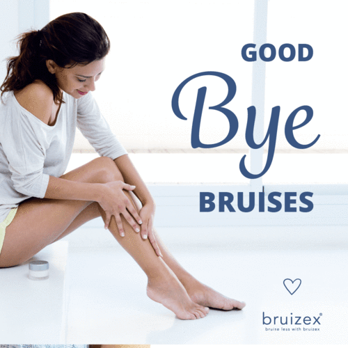 How to Heal Bruises