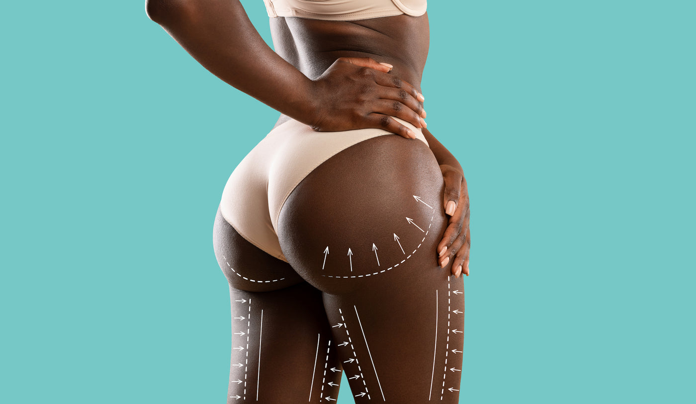 Understanding the Brazilian Butt Lift: A Guide to the Procedure and Essential Postoperative Care