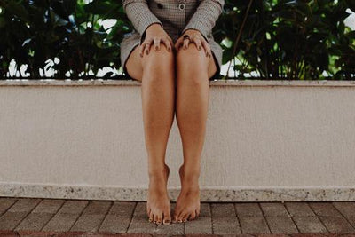 What Are Those Mysterious Bruises on My Legs All About?