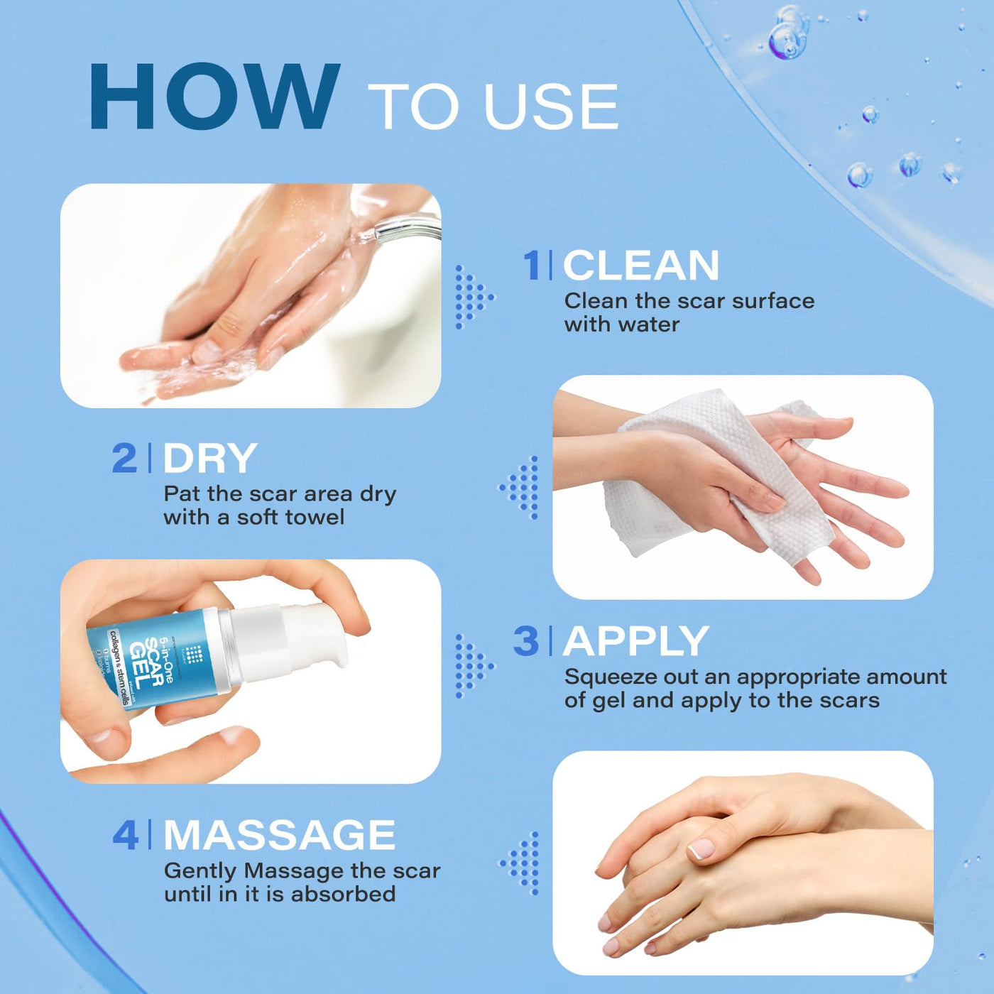 5-in-1 Scar Cream for Surgical Scars